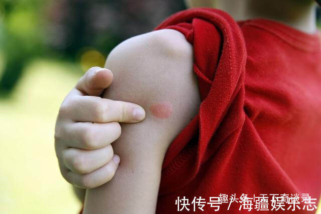 孩子|睡觉蚊子耳边叫，开了灯却找不到教你一笨招，孩子一夏天不被咬