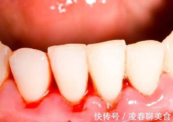 医生|小伙肝癌缠身，花光积蓄后离世，医生遗憾一种东西不能天天吃