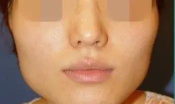 你周围大脸的女生多吗？拥有一张大脸是种怎样的感受？