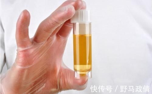 特点|男人晨起后，如果身体有几个特点，说明肾脏很强壮，不妨自测一下