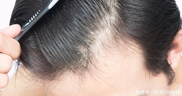 右肩|肝硬化害怕“1种水”,不是枸杞水,平时敞开喝,肝脏干净柔软