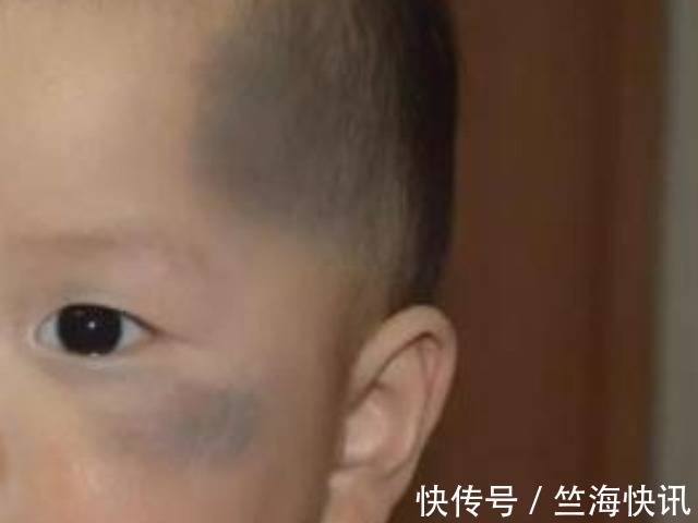 女人|女人怀孕后,尽量不要做4件事,以免宝宝脸上长胎记,别不当回事