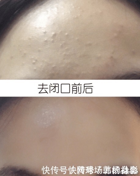 口红|买家秀与卖家秀“区别太大”,不是因为你没模特的五官,而是皮肤