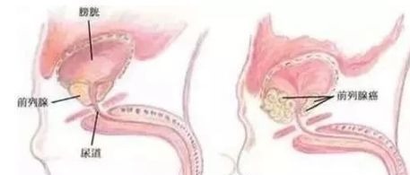 防癌|8种癌都怕这种菜!但99%的人都吃错了,配上它,营养翻倍~