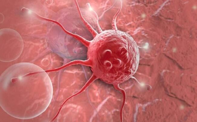 日常生活中|这些是癌症中常见的一些信号, 有一个, 你就需要当心了!