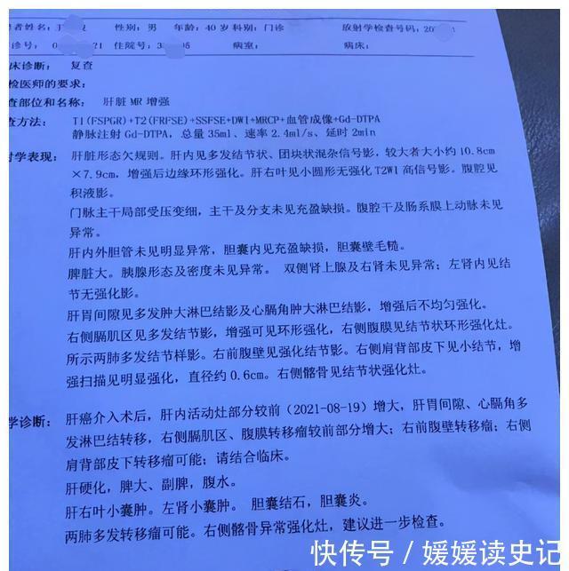 治疗|多方治疗无果的患者,加入中药后,肿瘤缩小一半