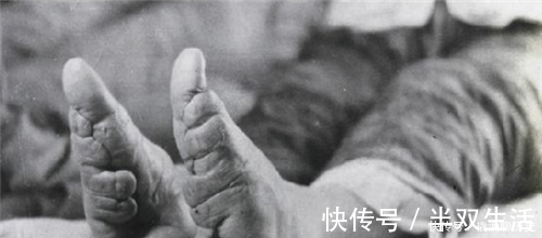 畸形#古代畸形审美,欧洲束腰中国缠足都已废除,唯日本将其传承了下来