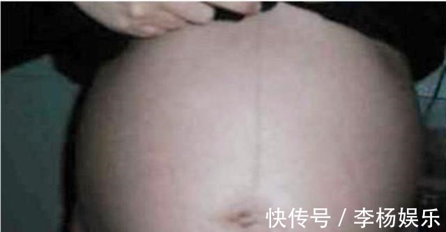 黑色素|孕期这些部位黑到“怀疑人生”,孕妈别担心,这是娃发育好的表现