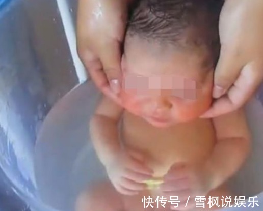 隐睾症|婆婆给出生5天的宝宝洗澡,突然尖叫一声,没想到改变了孩子一生
