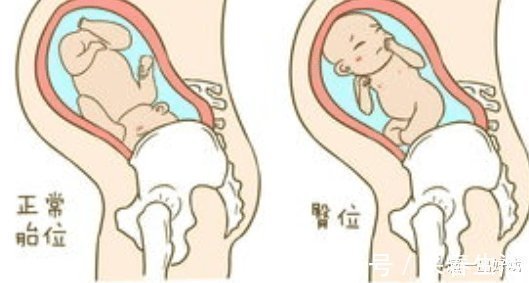 性生活|在怀孕之前,我们需要了解哪一些生殖常识呢?