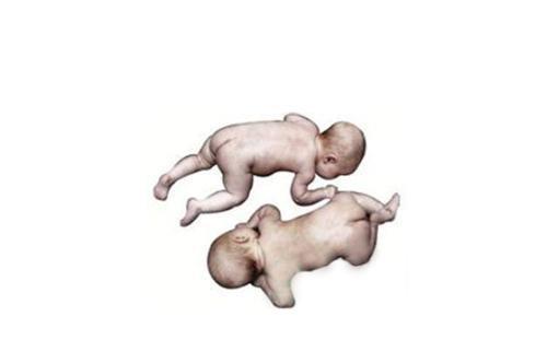 儿研所|宝宝得了婴儿痉挛症,该怎么治疗