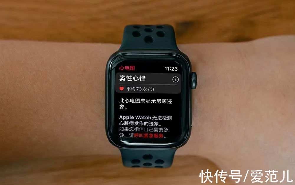 心电图|等了 3 年，国行版 Apple Watch 心电图功能终于来了