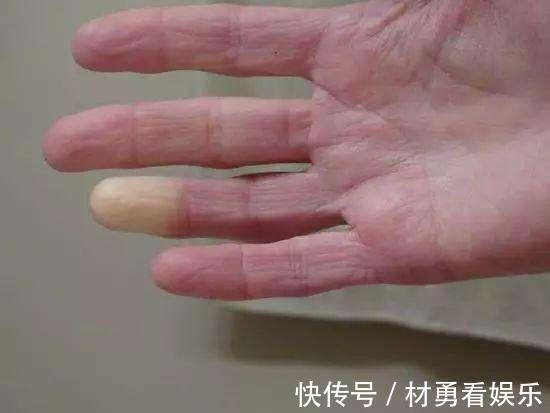 肢端|身上有三道“邪印儿”,说明健康要出问题