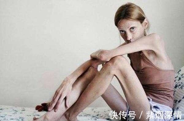身材|国外女子瘦到27公斤,走在街上人人都躲着她,增肥后却惊艳众人!