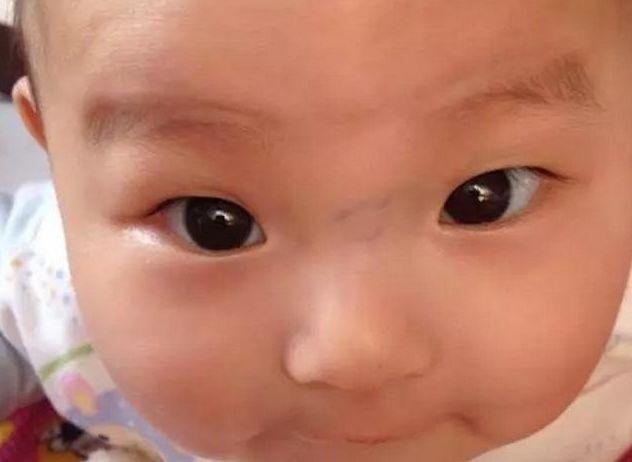 眼袋|孩子积食不消化,脸上3个异常不会“撒谎”,希望娃一个不占