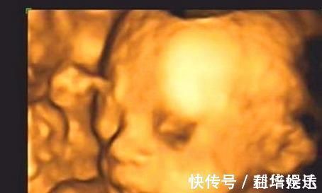 怀孕期间|孕期,若胎宝宝有这3个“表现”,可能是个“高智商”宝宝,恭喜