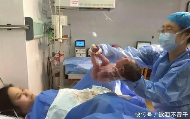 检查|孕妈生下双胞胎后,突然大喊“等一下”,医生检查后发现意外之喜