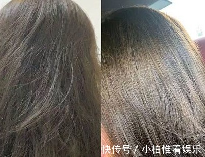 叶酸|新手孕妈福利!超新鲜待产经验+超精简实用待产清单,入门即高配