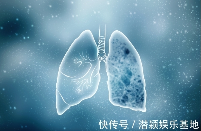 戒烟|吃一次等于5斤海带,主任:没事喝2口,散“结节”,肺越来越红润