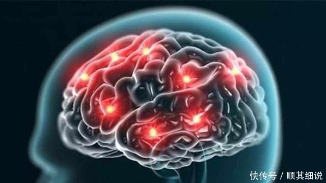 减少|脑部供血不足的人,身体可能有4个表现,不妨自检一下