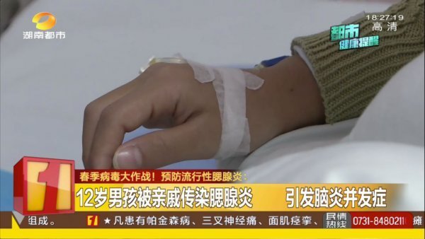 腮腺|这种病传染性极强！12岁男孩跟亲戚玩耍后，耳下突然有点痛…