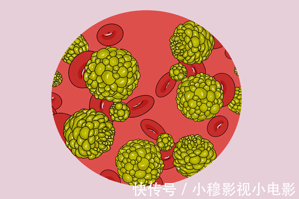 发物|为什么癌症患者容易疲劳？面对“癌性疲劳”，应该怎么办？