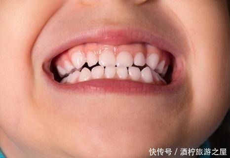 双排牙|7岁男孩乳牙未掉，恒牙又长，医生检查后说道幸亏来得及时