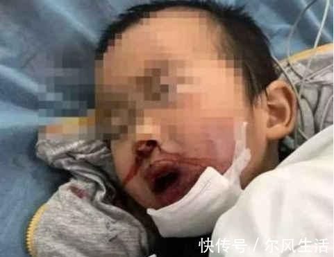 抢救|又一个孩子因它而忘, 这救命的“良方”家长赶紧学起来