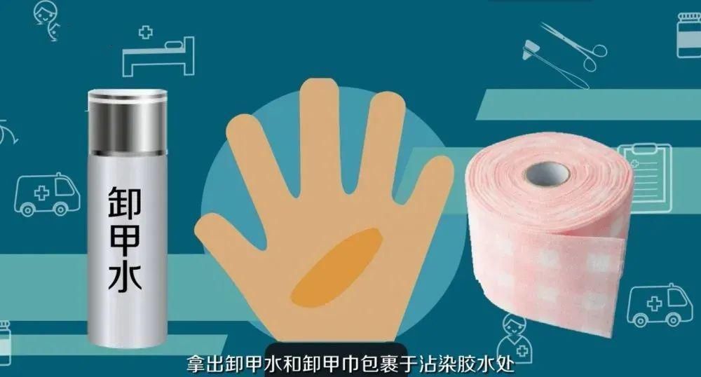 孩子|孩子被502胶水黏住了手怎么办？别慌，教你轻松搞定！