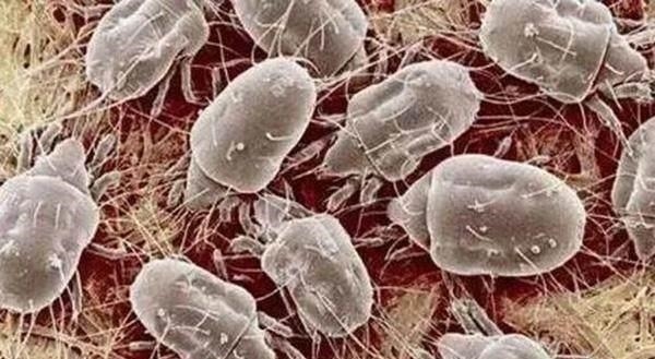 它是螨虫的克星!放在床垫下,再也不怕床上有螨虫!