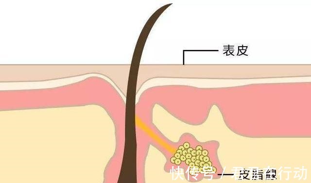 区别|“坚持美白”和“坚持补水”,10年后有什么区别原来差距这么大!