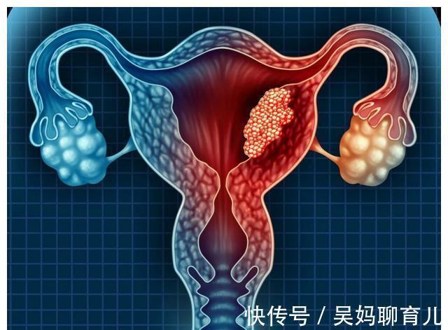 宫颈|提醒广大女性:一般情况下,3种“妇科病”不用治,别自己吓自己