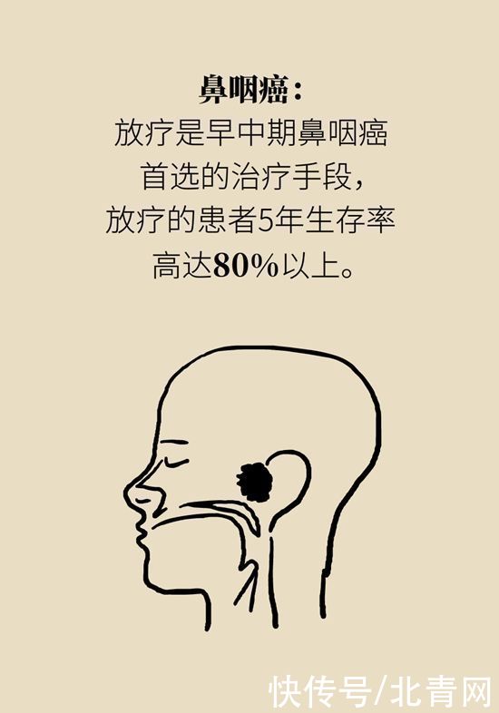 肿瘤|一半以上的肿瘤需要放疗，害怕辐射不如了解一下