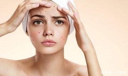 葛根粉|女人“雌激素”偏低，身体可能会有3个“表现”希望你一个都没