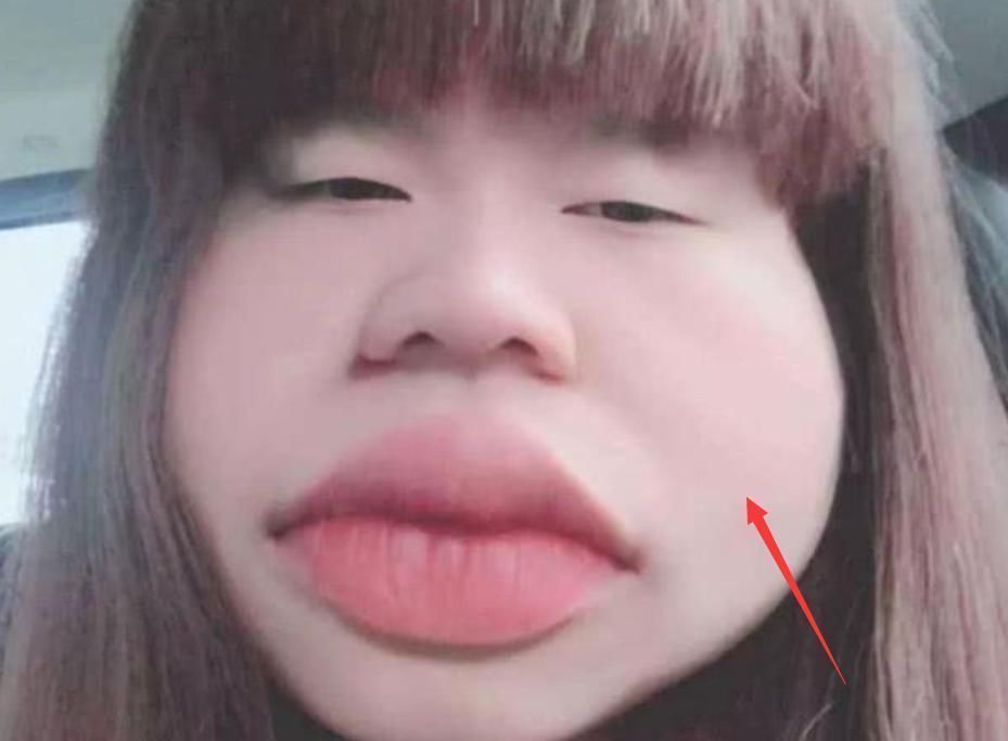 女生的脸“尺寸”变得越来越大多半因这3习惯,学生党要“趁早”改