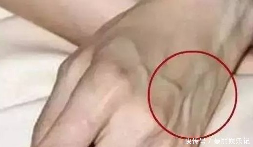 肝脏好的人，手上都有这“5个标志”，看看你的手上有没有