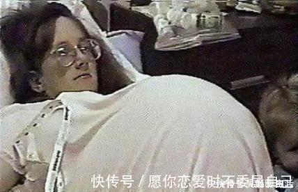 医学技术|世界首例7胞胎,每天42瓶奶粉,52个尿片,23年了,现状令人羡慕