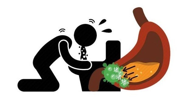 特异性|胰腺癌早期不声不响?医生告诫:上半身出现3种异常,千万别拖