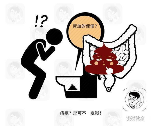 大肠癌|肠道有癌，大便先知排便时若有4个异常，是直肠癌“警报”