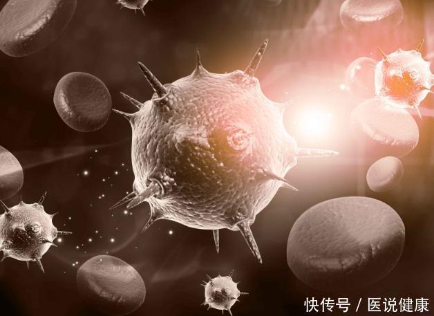 腺瘤性息肉|什么叫“癌前病变”这四类常见的癌前病变，现在了解还不算晚