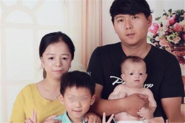 王女士|还记得那个25岁的“鸟脸妈妈”吗?孩子不幸遗传疾病,如今怎样