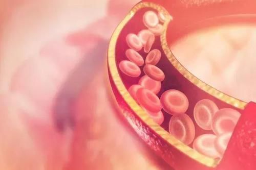 高血脂患者|身体出现这4个迹象,说明你的血脂超标了,别让心梗趁虚而入!