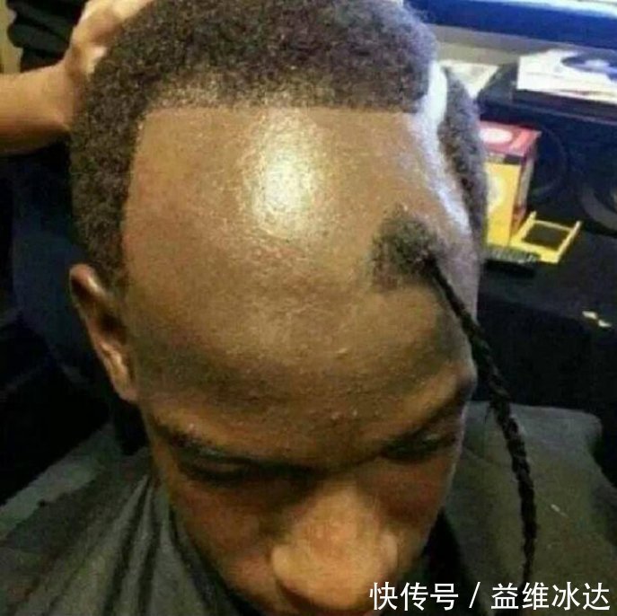 发型 最失败发型:卷毛在中间,刘海挂两边哈哈哈,你是男是女呀?