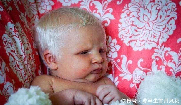 医生|婴儿刚出生就满头白发，医生说这几率太低了，长大没想到这么好看
