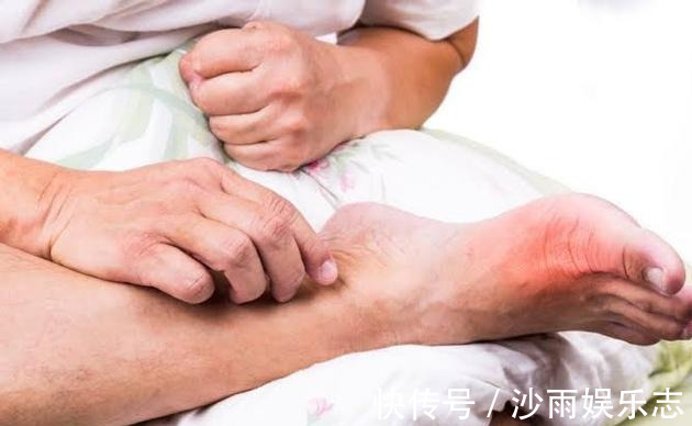 苏打水|痛风患者，喝柠檬水、苏打水能把尿酸降正常吗医生告诉您