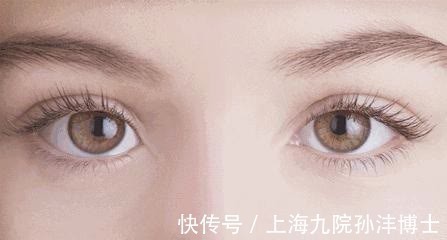 泪液 孙沣博士:双眼皮手术后,眼睛总爱流泪是正常情况吗?