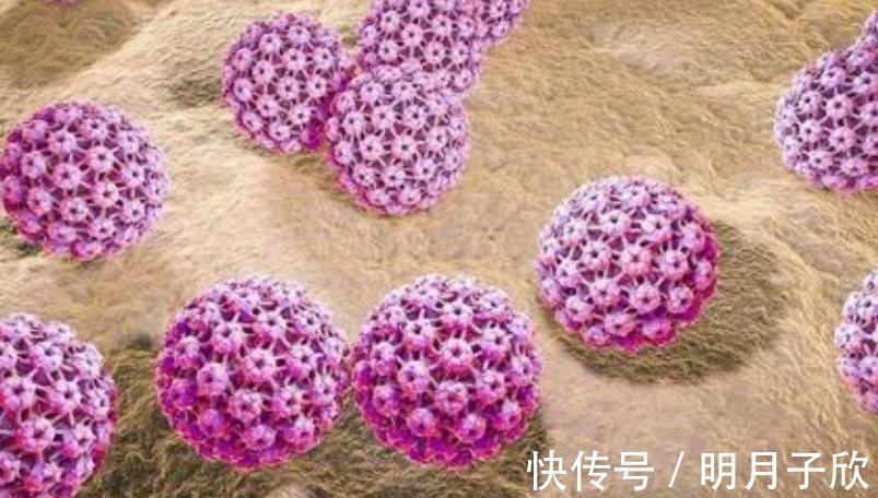 白带|宫颈癌“看上你”,身上可能有3种表现,希望你不要占一个!