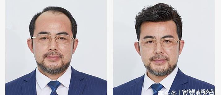 光头|男人过了四十别剃“光头”，三种帅气发型，让油腻大叔变回小鲜肉