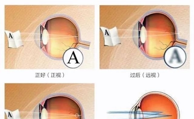 视力|保护孩子视力成长的关键,这3点家长要尽快去做来预防近视