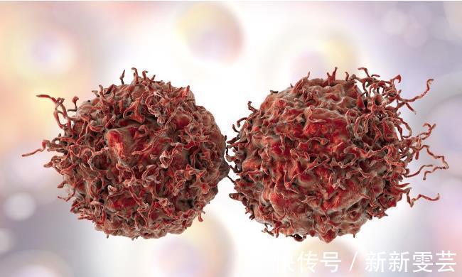 复发|癌症能不能治愈？肿瘤专家：满足这三个条件，就可以